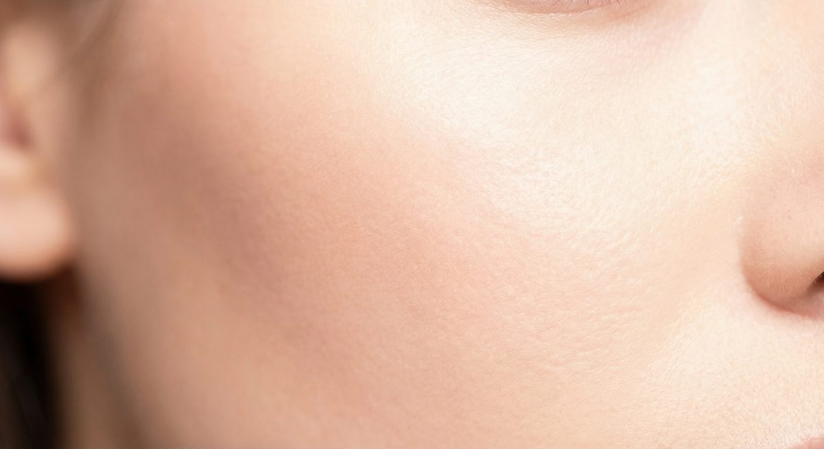 Como tratar cicatriz de acne com seguranca